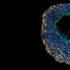 The Netherlands Cancer Institute, Multicellulaire sferoïde: een 3D-bol van kankercellen die in het laboratorium is gemaakt om het effect van radiotherapie te bestuderen.