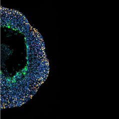 NKI, Multicellulaire sferoïde: een 3D-bol van kankercellen die in het laboratorium is gemaakt om het effect van radiotherapie te bestuderen.